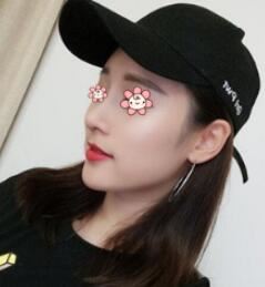 陈宇